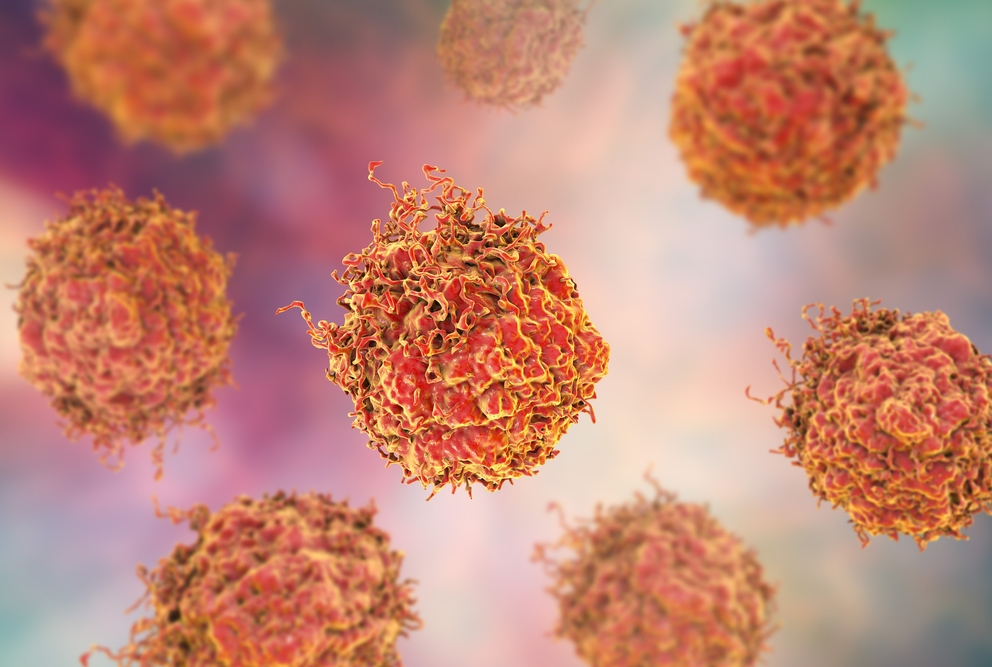 illustration of prostate cancer cells.
